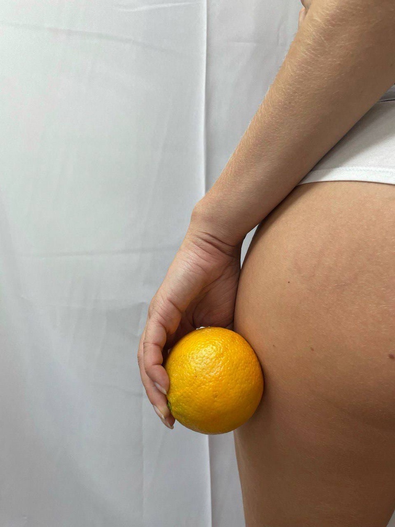 Массаж сухой щеткой: разгоняем лимфу